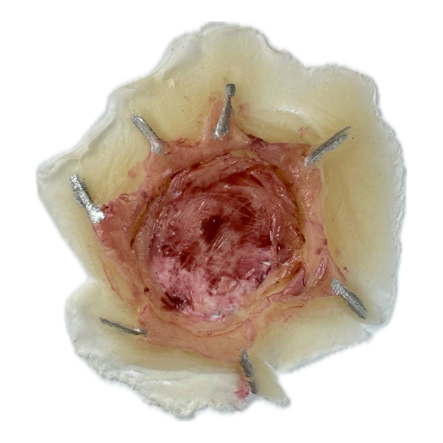 Small Sutured Hole