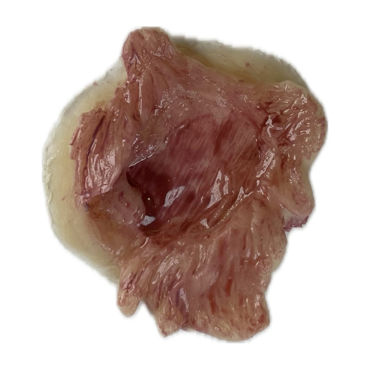 Large Exit Wound
