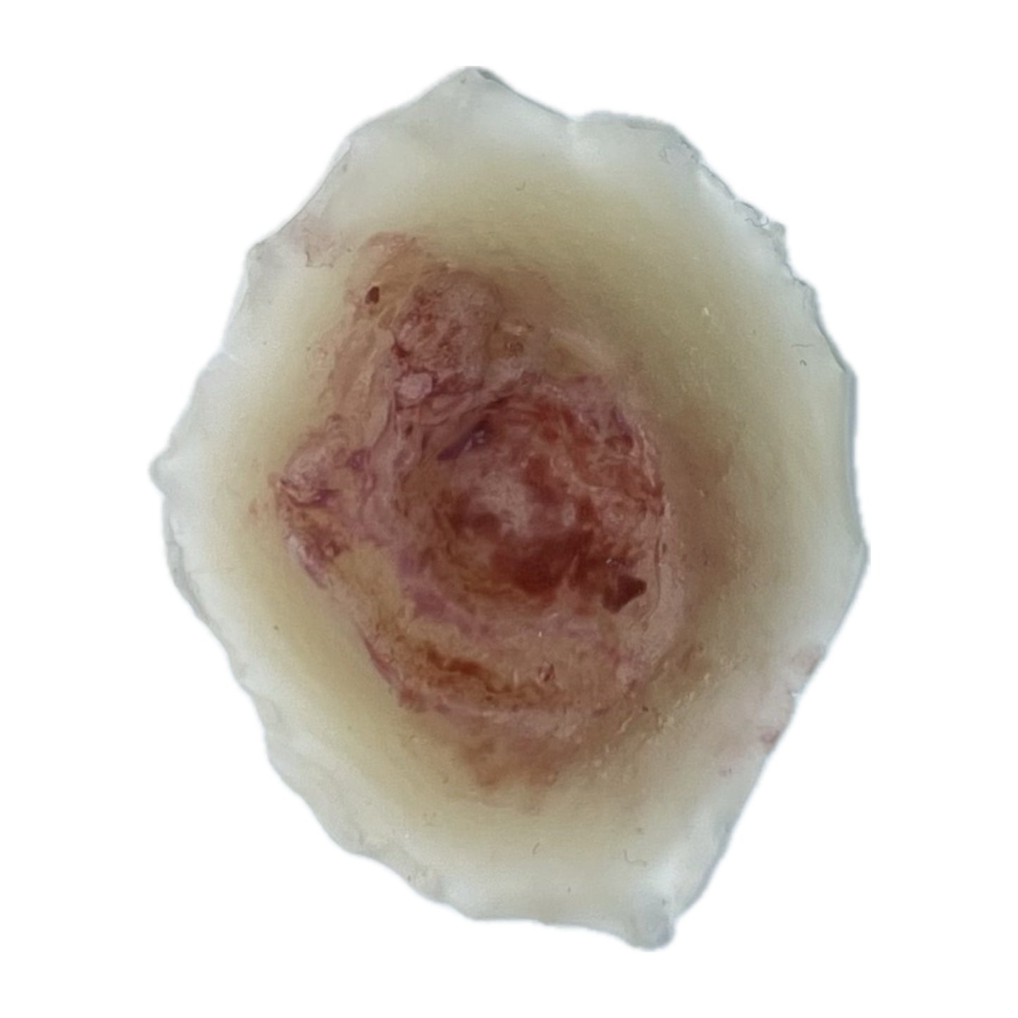 Small Exit Wound