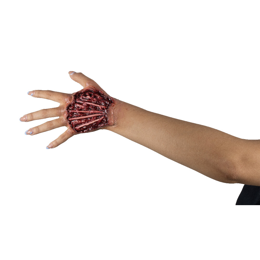 Tendon Injury Prosthetic