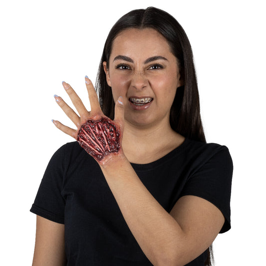 Tendon Injury Prosthetic