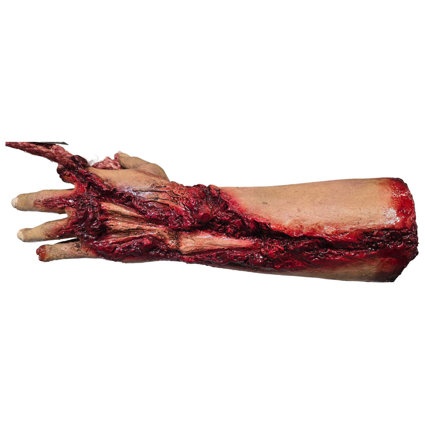 Mutilated Forearm