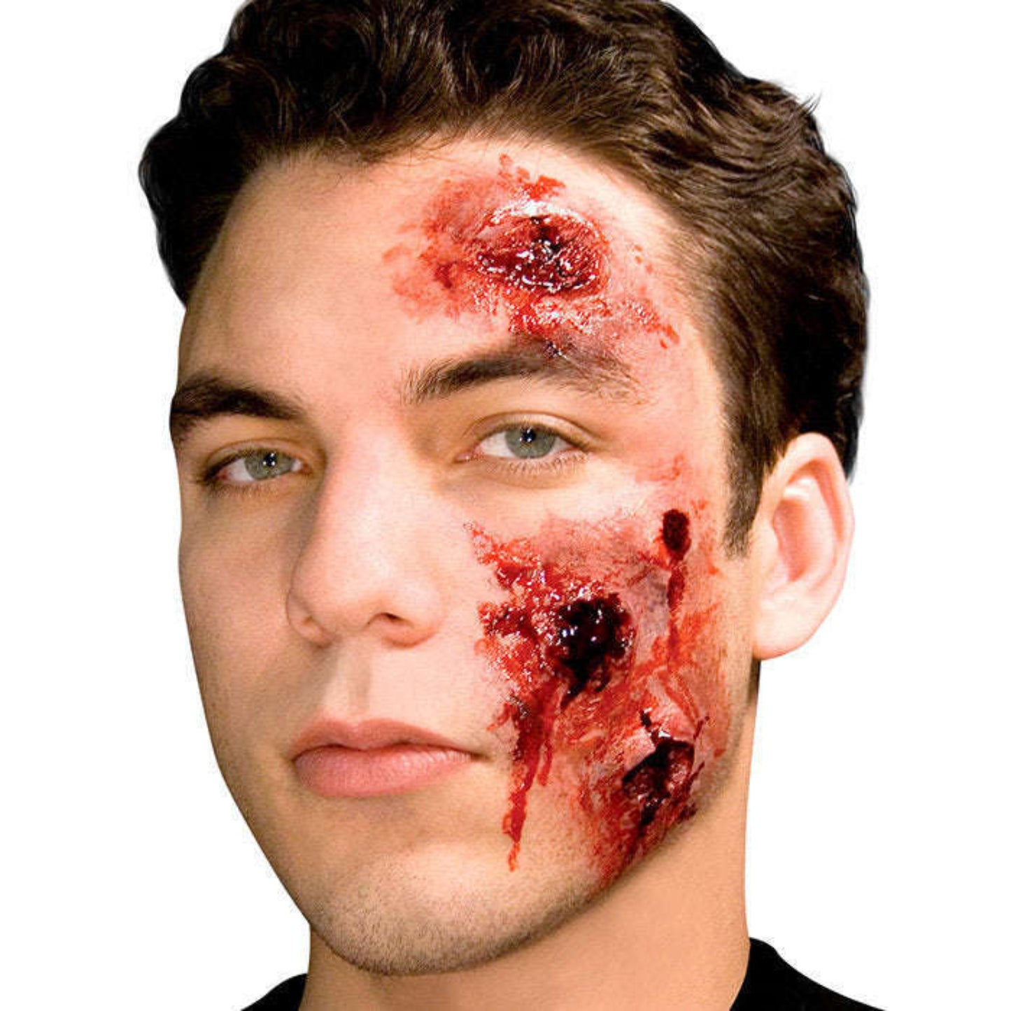 Woochie Capped Prosthetic
