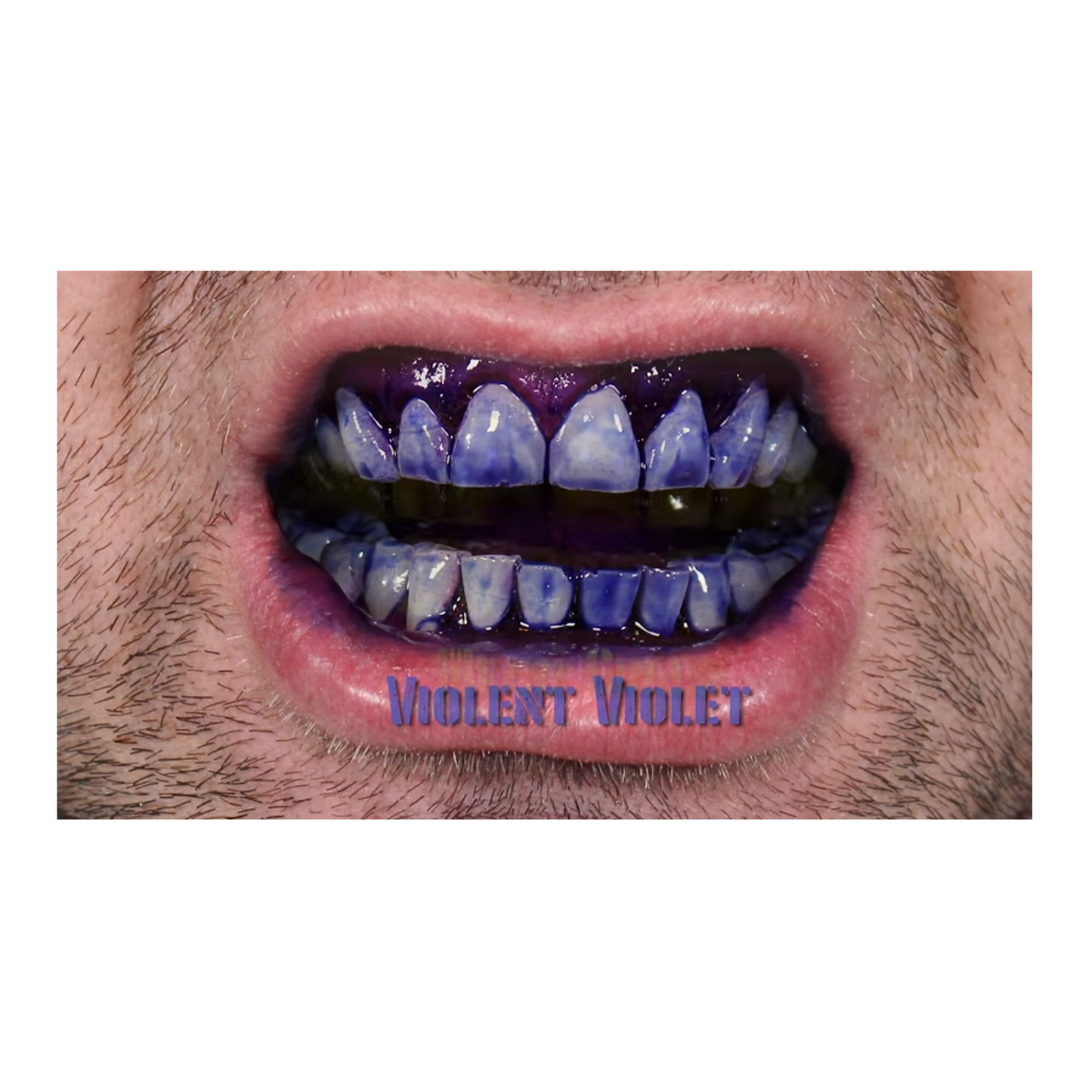 Necessary Evil Mouth FX - Singles and Kits