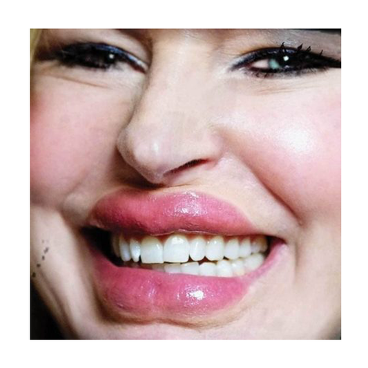 Tinsley Lip/Tuck 3D FX Transfer