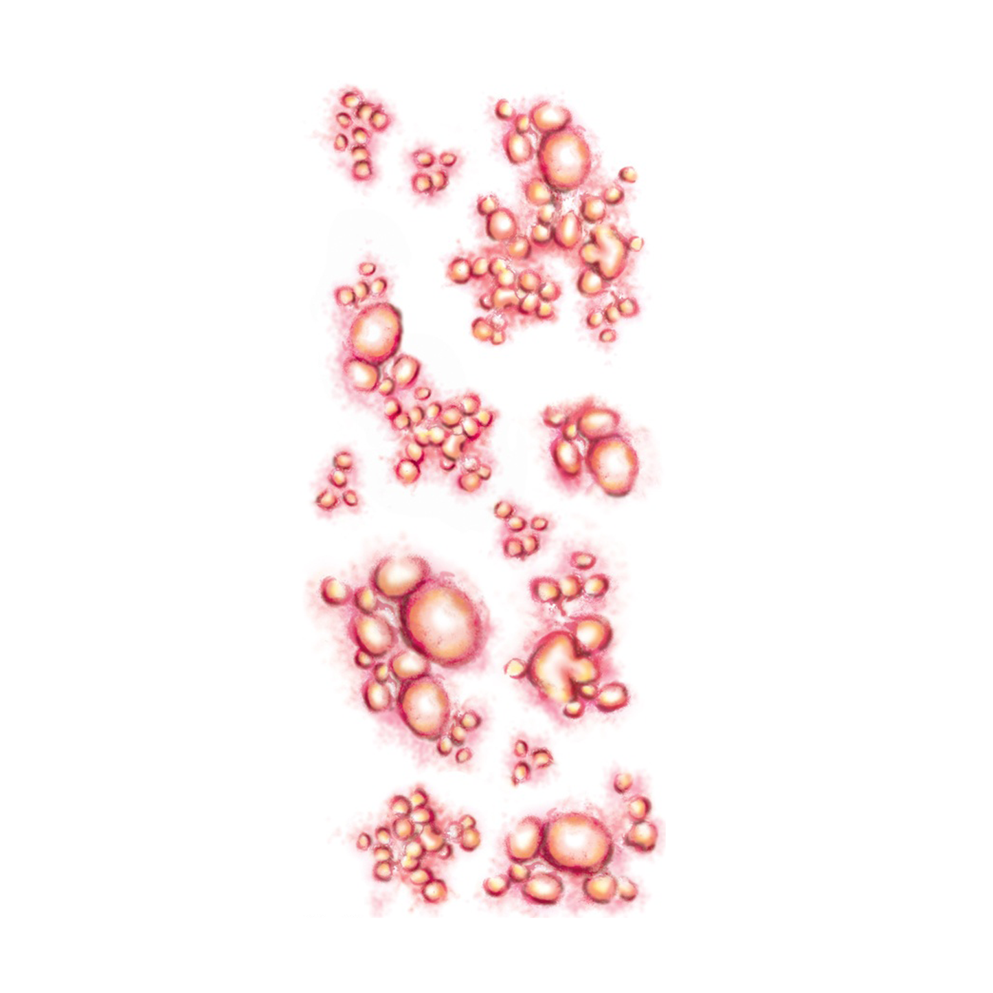 Tinsley Diseased Tattoo