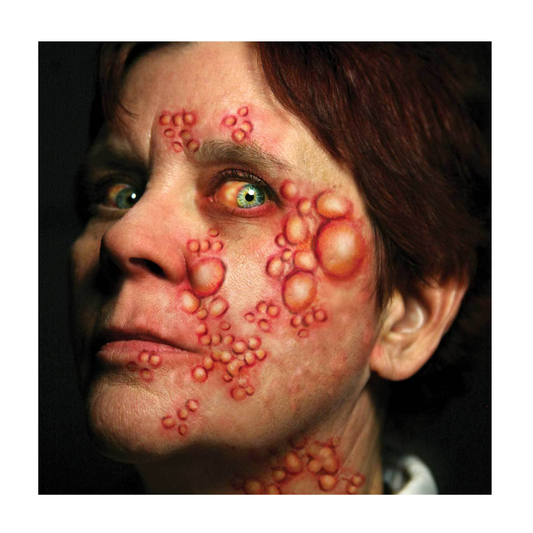 Tinsley Diseased Tattoo