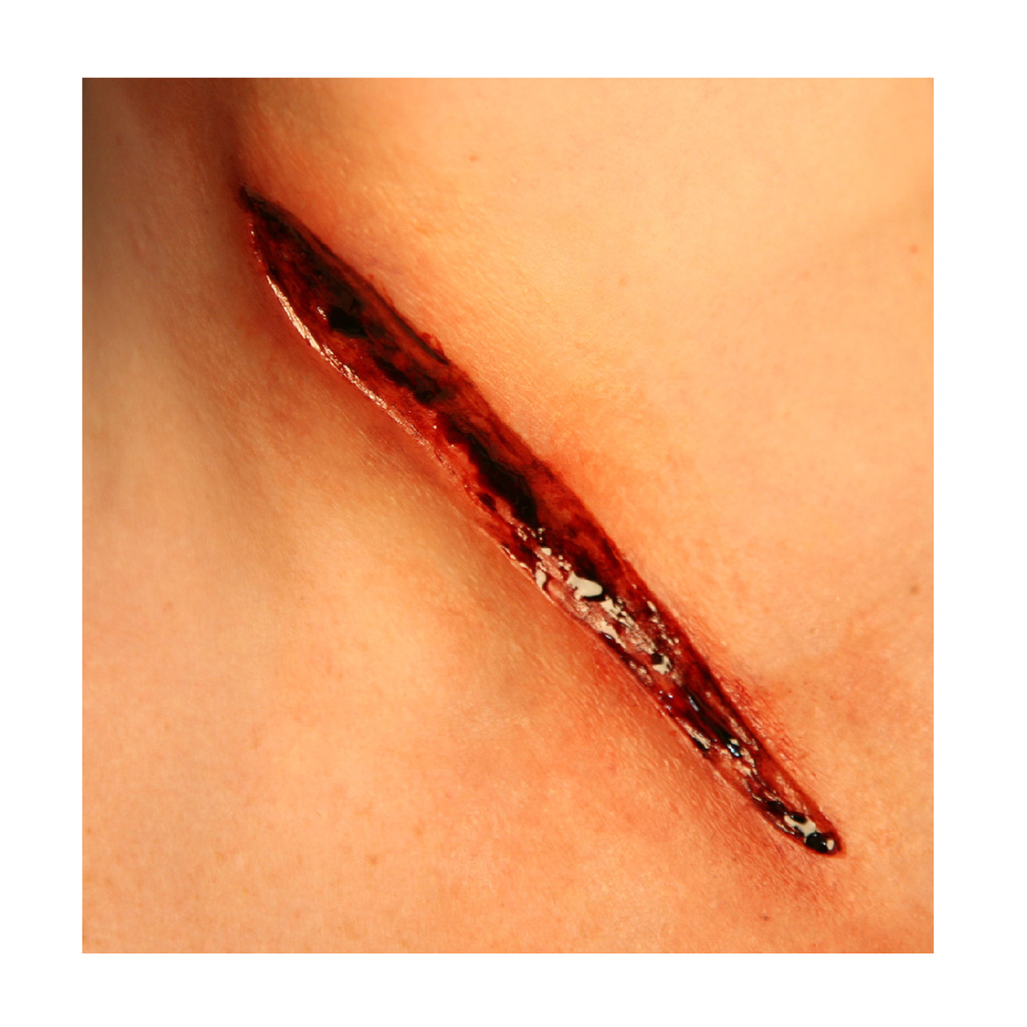 6" Laceration Mold