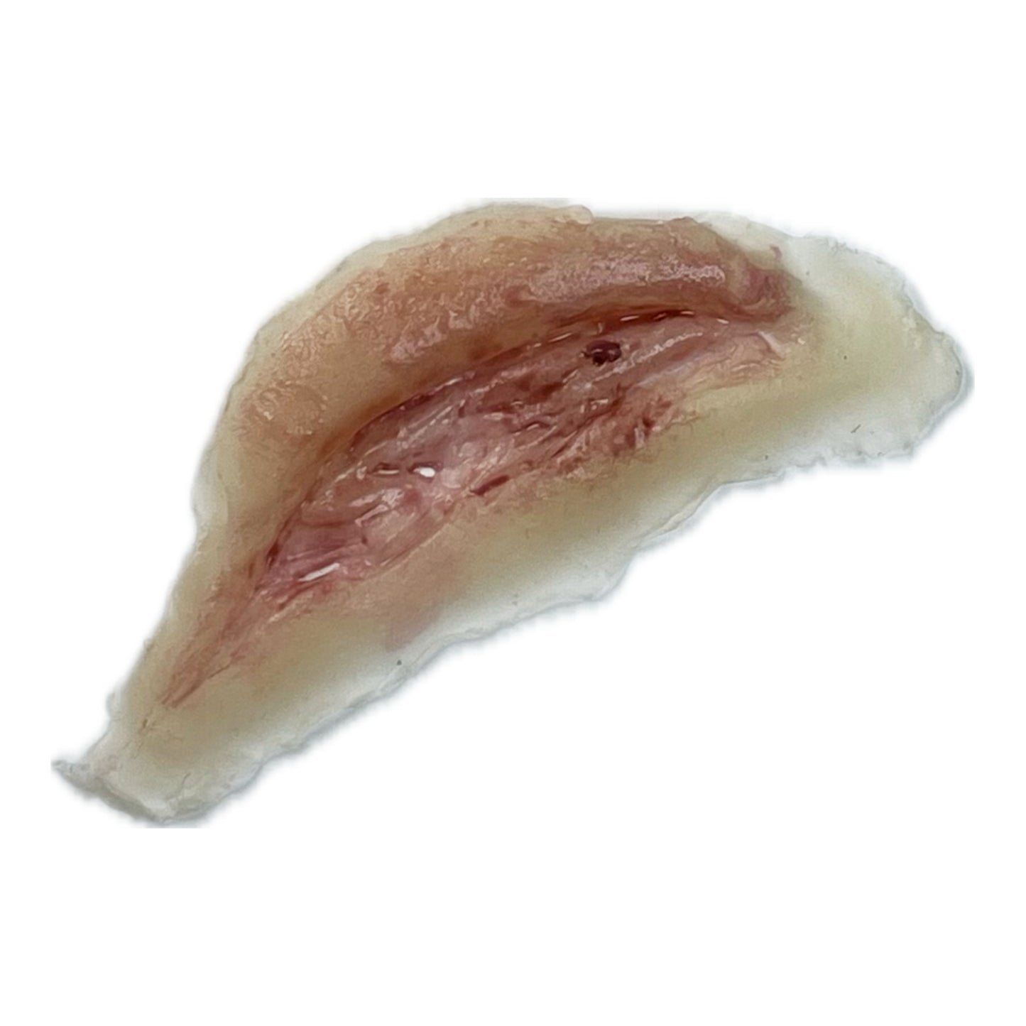 Small Slice with Skin Flap