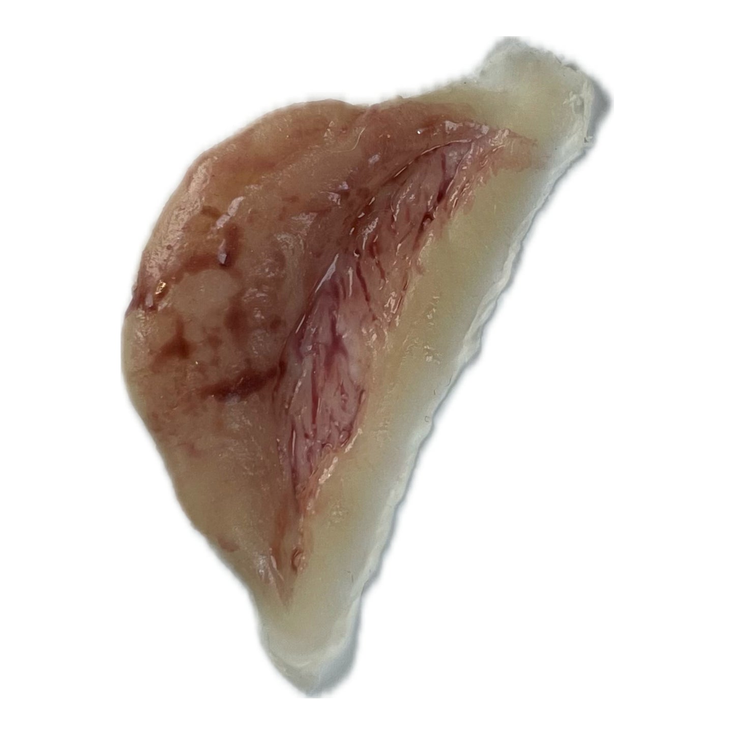 Small Slice with Large Skin Flap