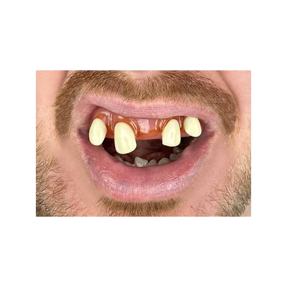 Billy Bob Tiger Man Teeth