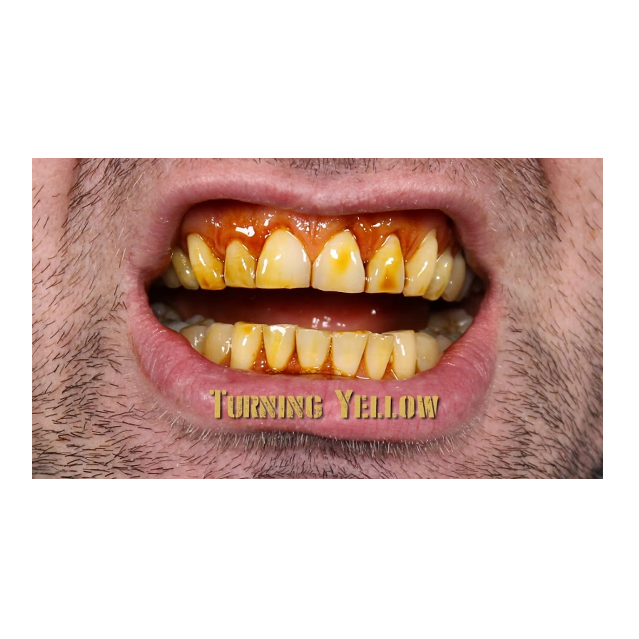 Necessary Evil Mouth FX - Singles and Kits