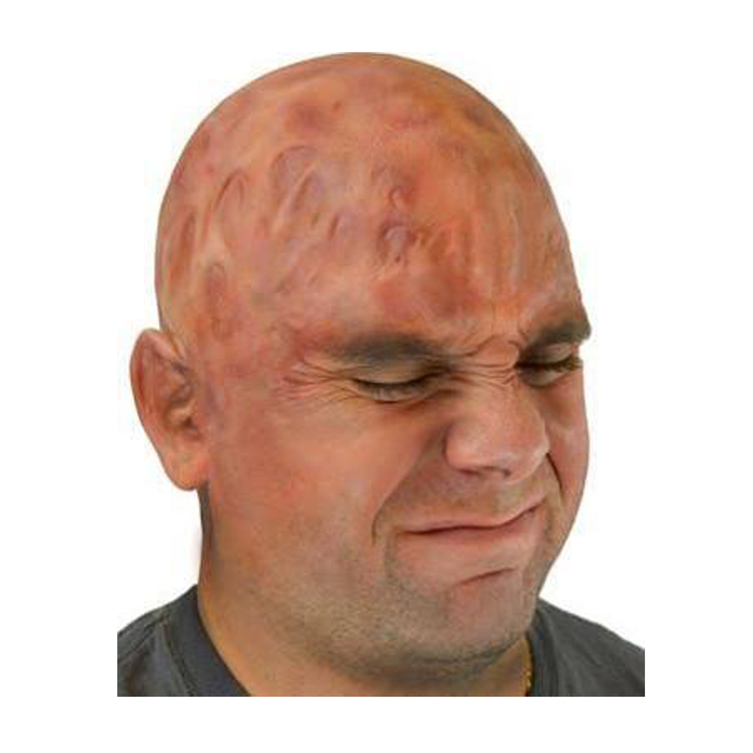 Woochie Burn Bald Cap Prosthetic